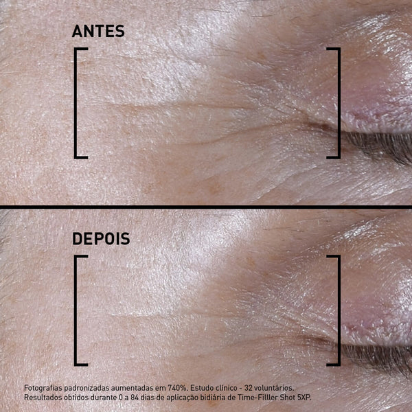 Resultados antes e depois de usar Time Filler Shot 5Xp