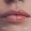 Resultados antes e depois de usar Hyalu Filler Lips