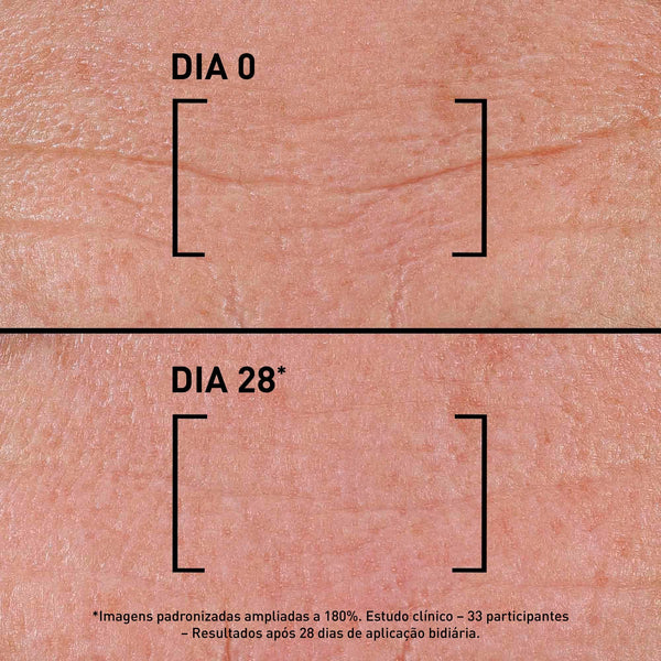 Resultados antes e depois de usar Time Filler Intensive 5Xp