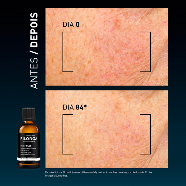 DAILY PEEL – DARK SPOTS